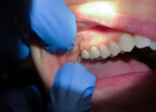 Best Weekend Emergency Dentist in Bethel Acres, OK